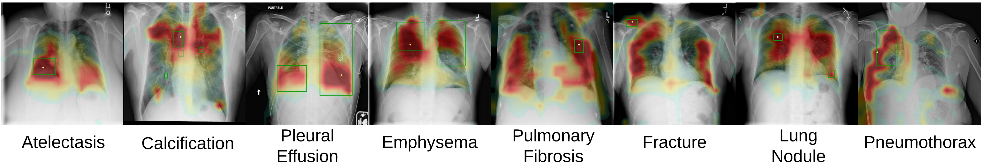 Similarity maps produced by FLaS on ChestXDet10 positive cases, each marked at the pixel of highest attention.