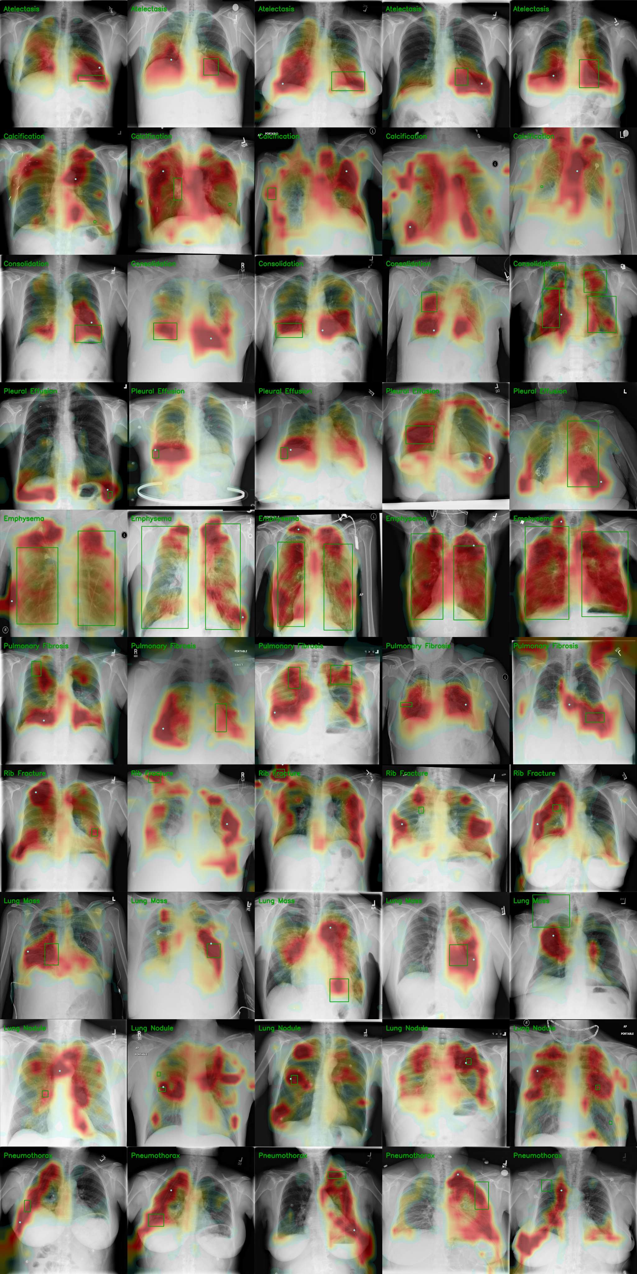 ChestXDet10 grounding maps where the attention peak falls outside the ground-truth box.